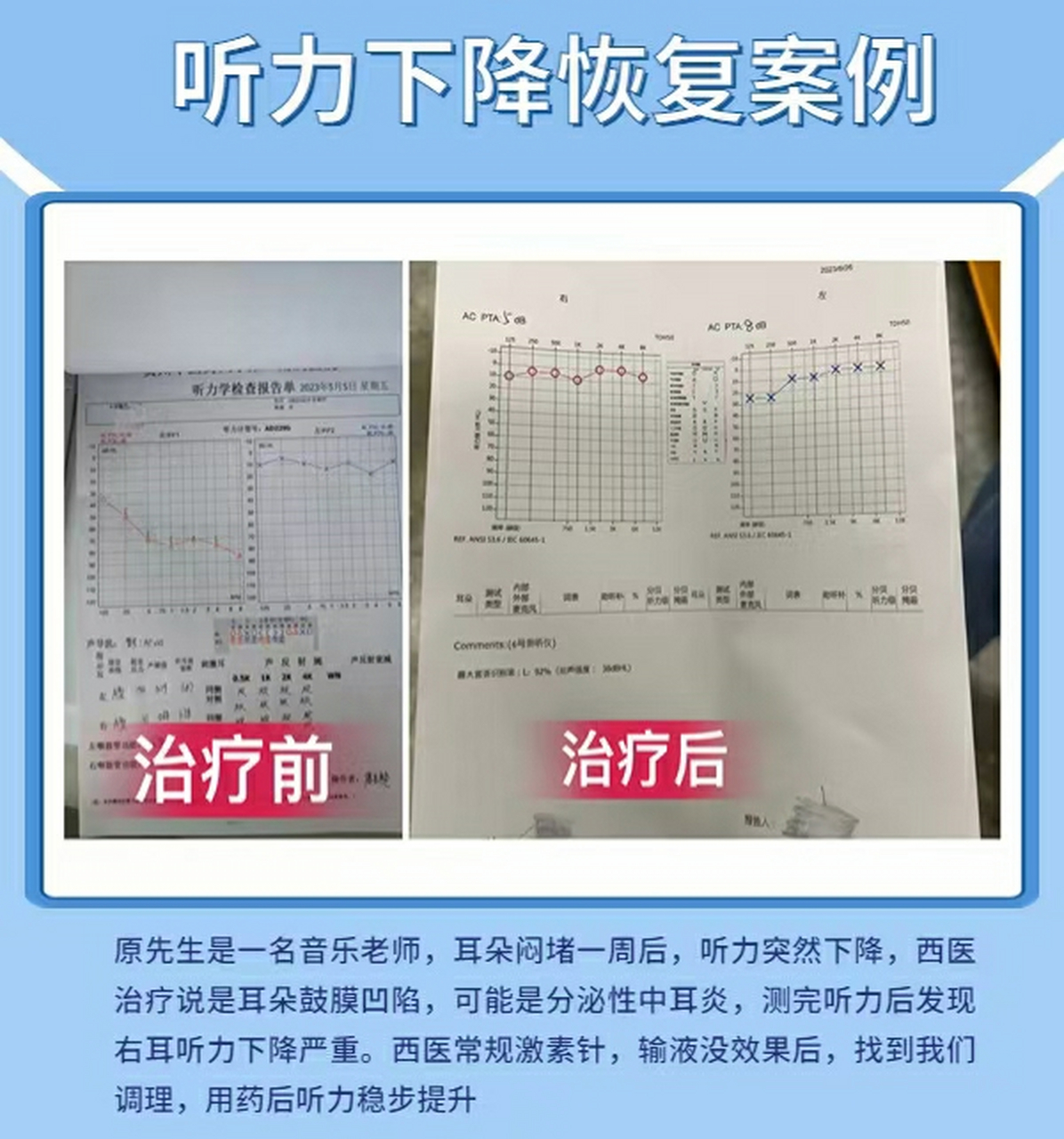 好转病例分享75 我是中医李桂英主任,临床经验已有近40年.