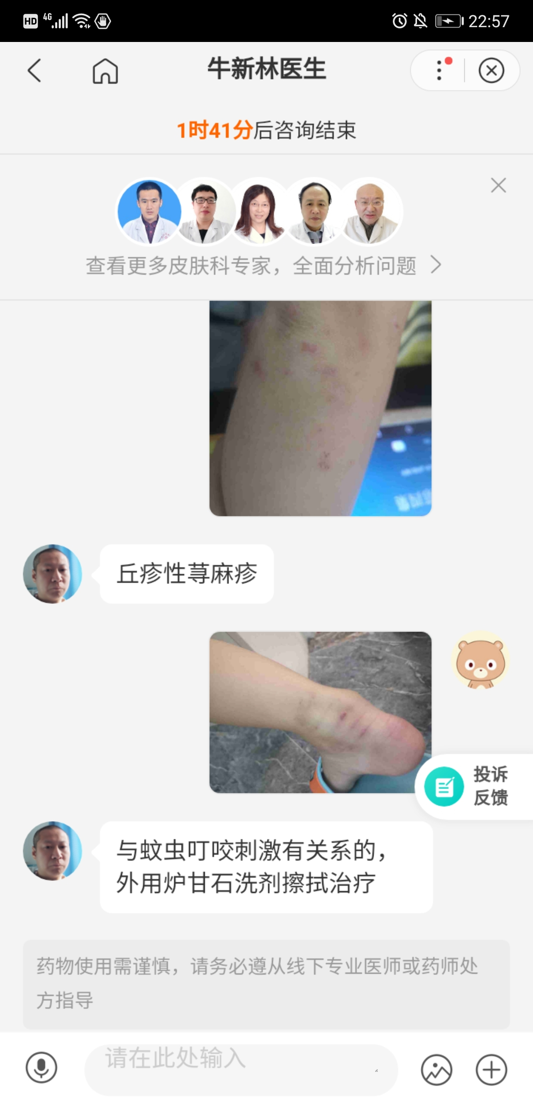 如何區分丘疹性蕁麻疹