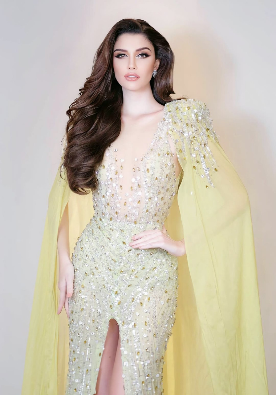 伊莎贝拉·梅宁现年26岁,是一名模特和企业家.