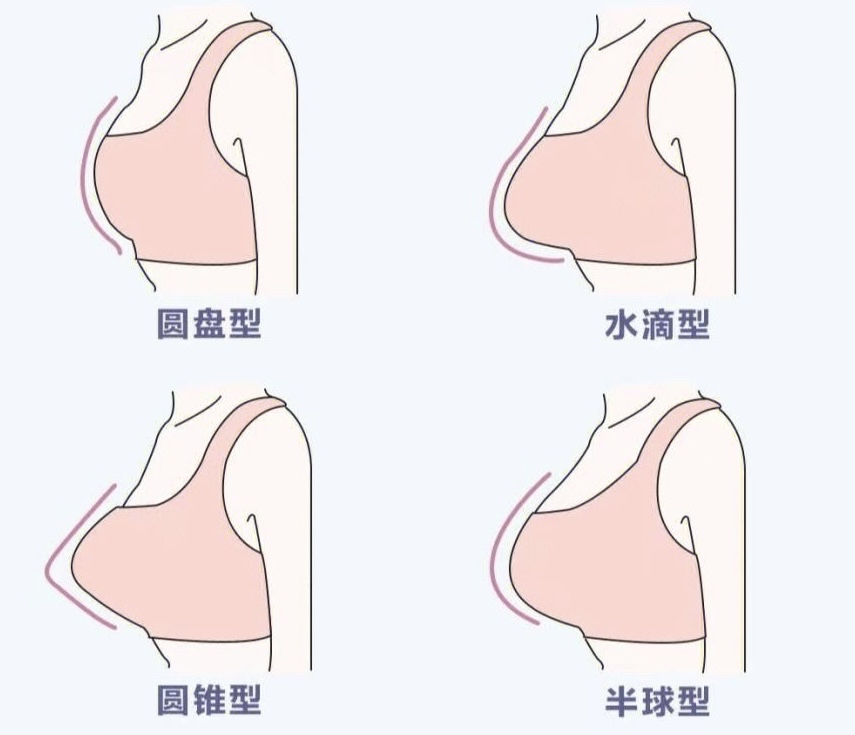 你pick哪一款?胸型水滴型和下垂型的区别是什么?