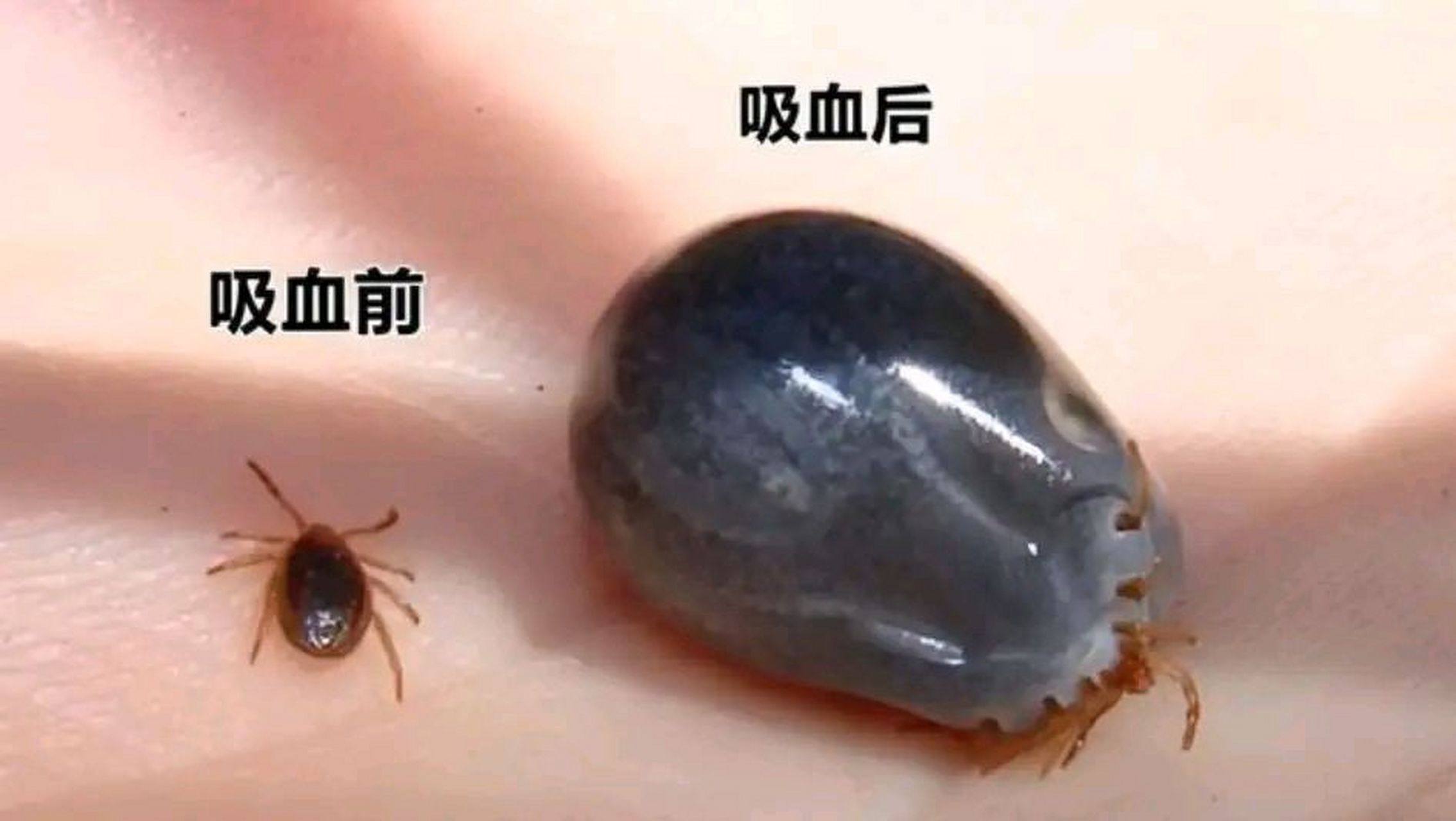 三岁孩子被蜱虫咬伤,爸爸"三步"救了娃  "乐乐(化名)爸爸,这个周末别