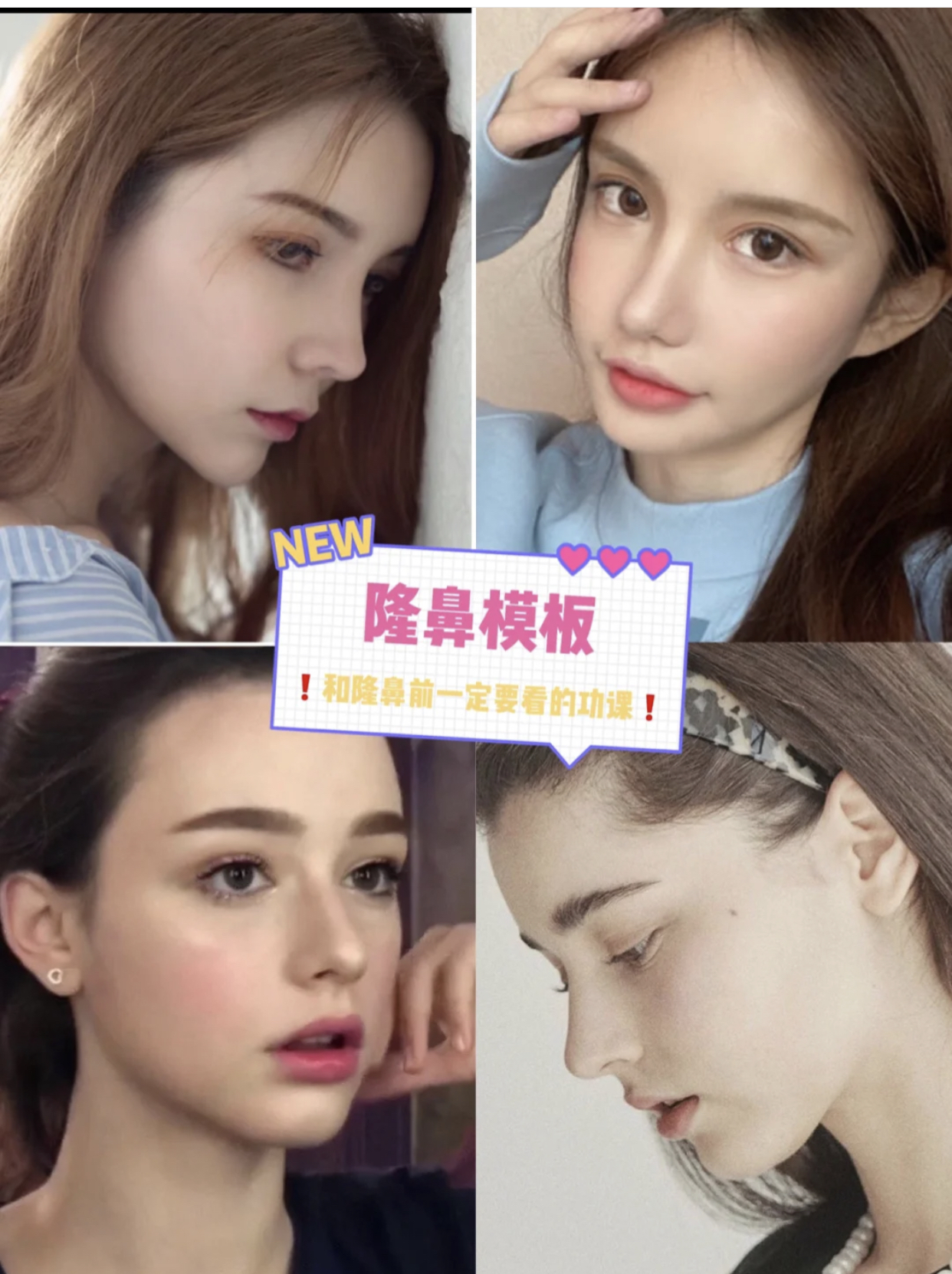 混血鼻模板 隆鼻前必看功课