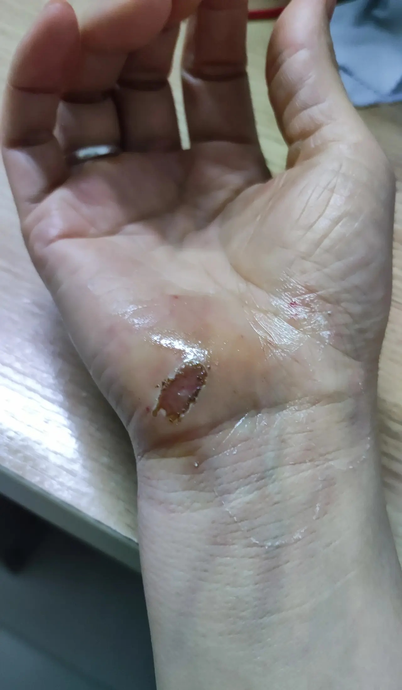 说赔点钱给我去看看医生,电动车摔倒照片被车撞了人受伤的图片被车撞