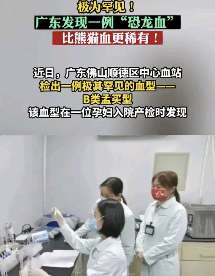 比熊猫血更罕见血型图片