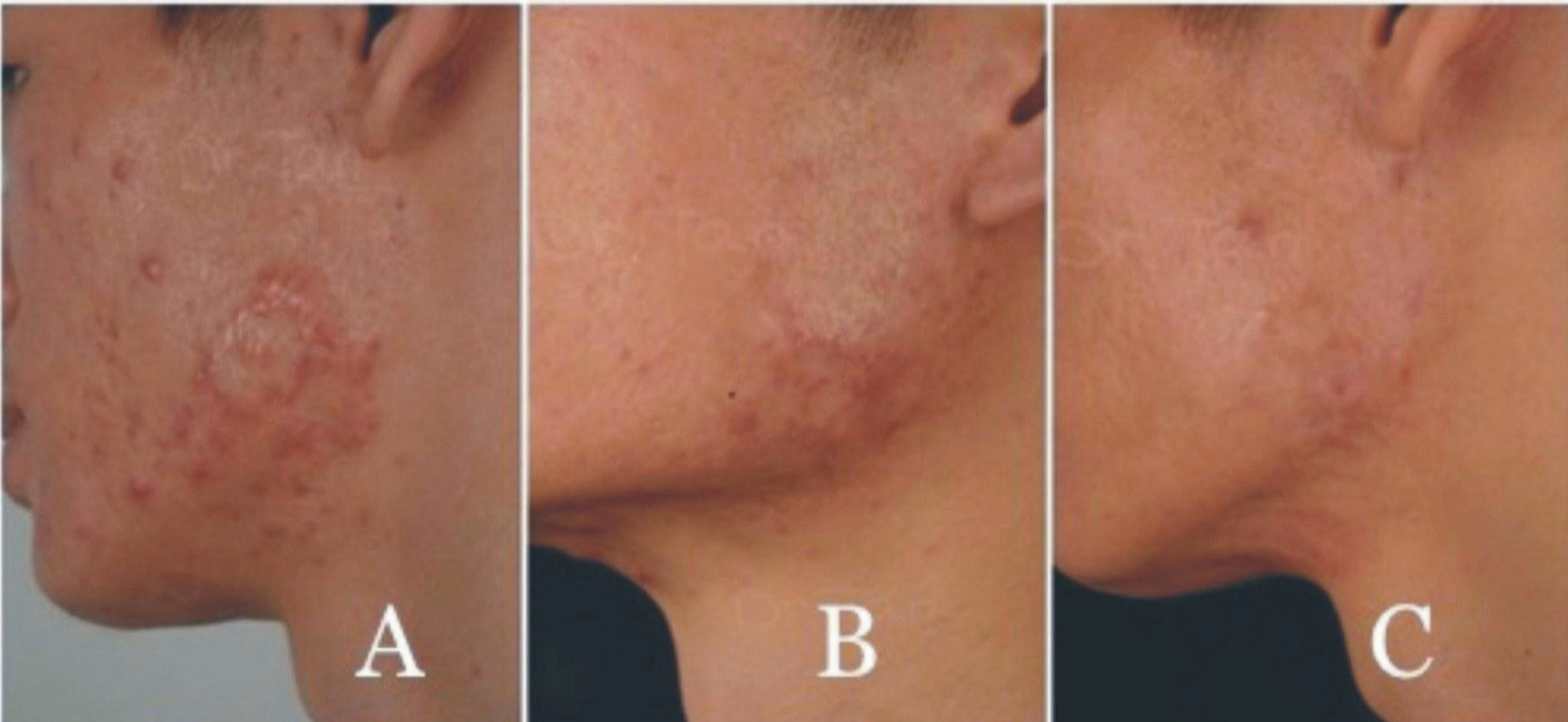 这种问题通常发生在手术,创伤或其他皮肤损伤后.