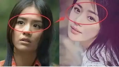 马思纯做双眼皮踩的坑,我劝大家别踩!