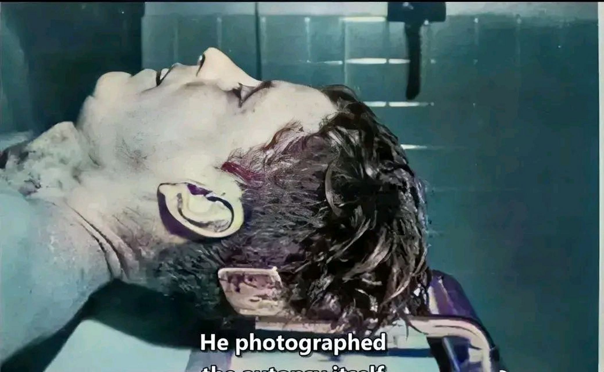 1963年,肯尼迪遇刺身亡后,尸检的现场,一张罕见的留影,经过法医的检查