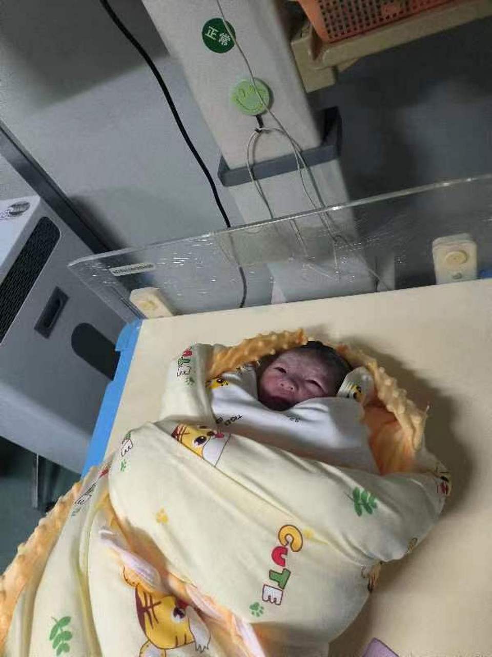 昨天下午生的男宝一枚,孕36周宝宝就发动了,顺产4