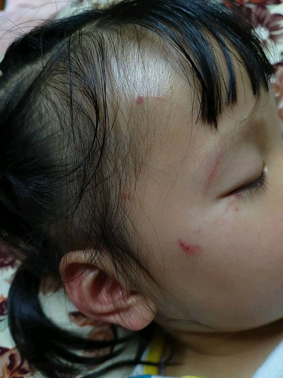 我说这是被我老公打的,你们相信吗?