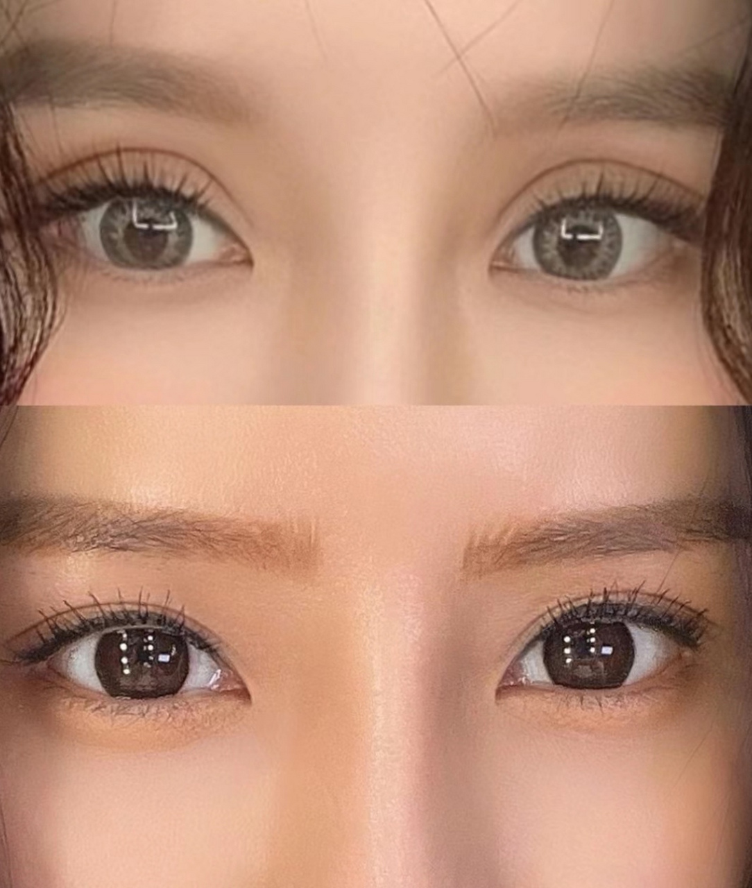 假宽深欧式双眼皮改扇形,气质逆袭!