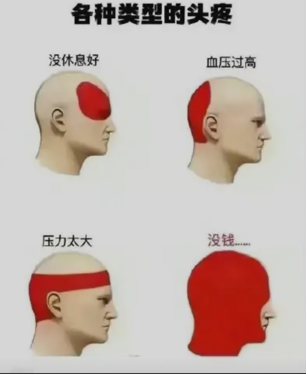 没钱是真的头疼