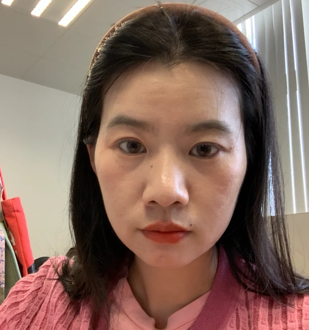 四大垮脸特征自测,显得面相又老又凶,20岁也别忽略,你中了几个