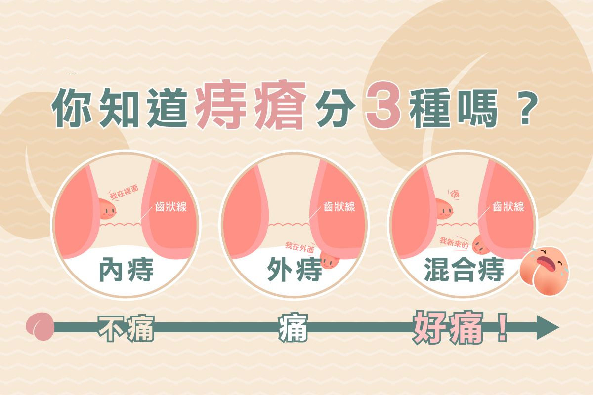痔仓 baijiahao.baidu.com