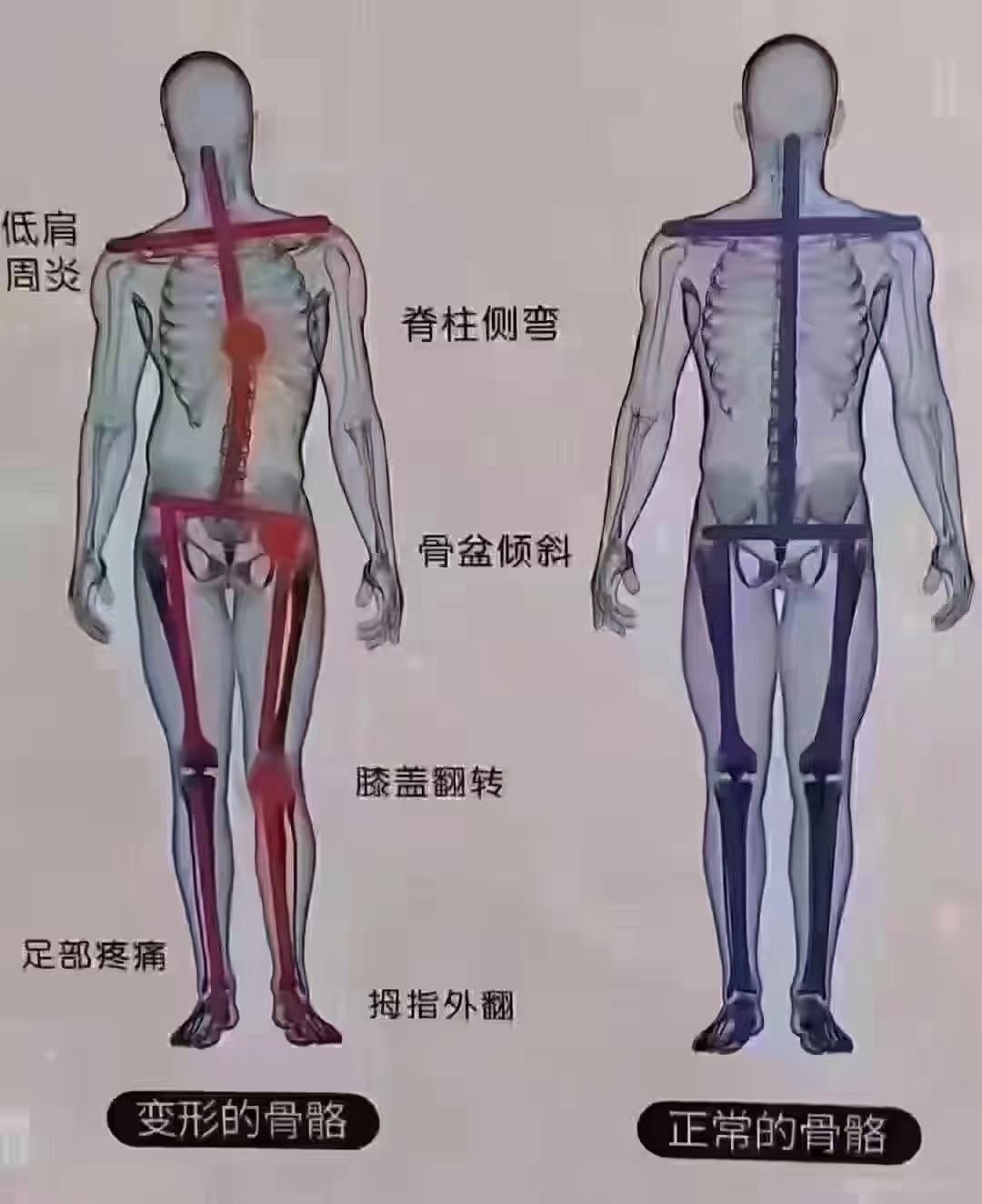 太极站桩的好处-外塑形