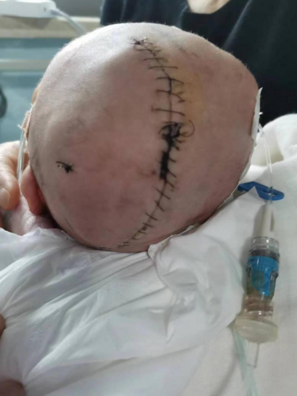 四川德阳,一对夫妻在2月14日迎来他们的"爱情结晶"