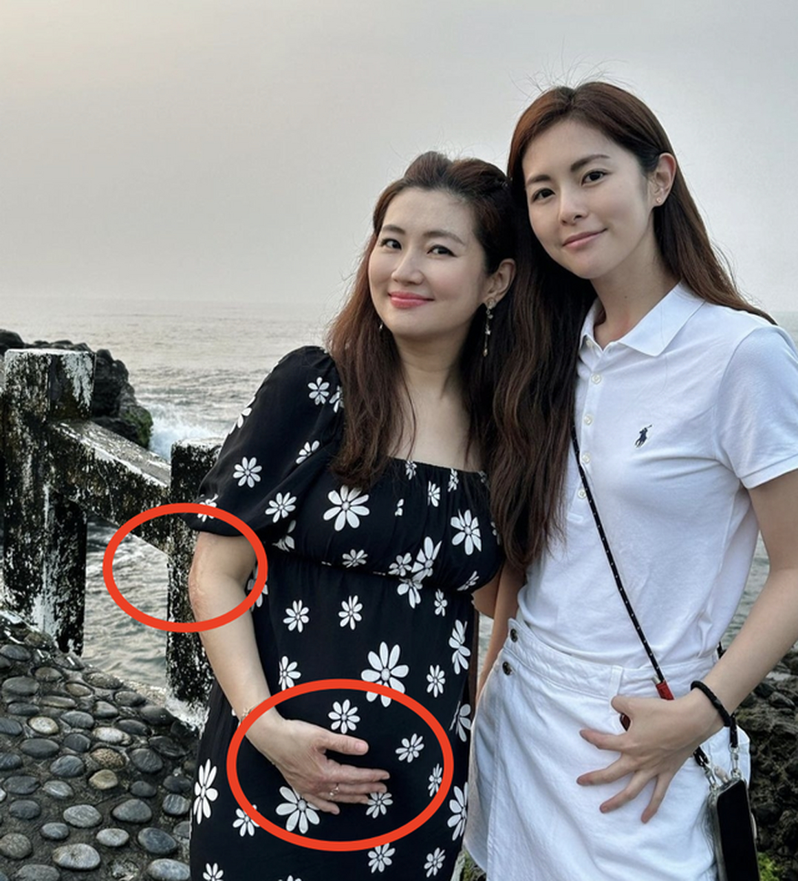 selina挺孕肚和男友出游,不惧腿上疤痕明显,自信大方!