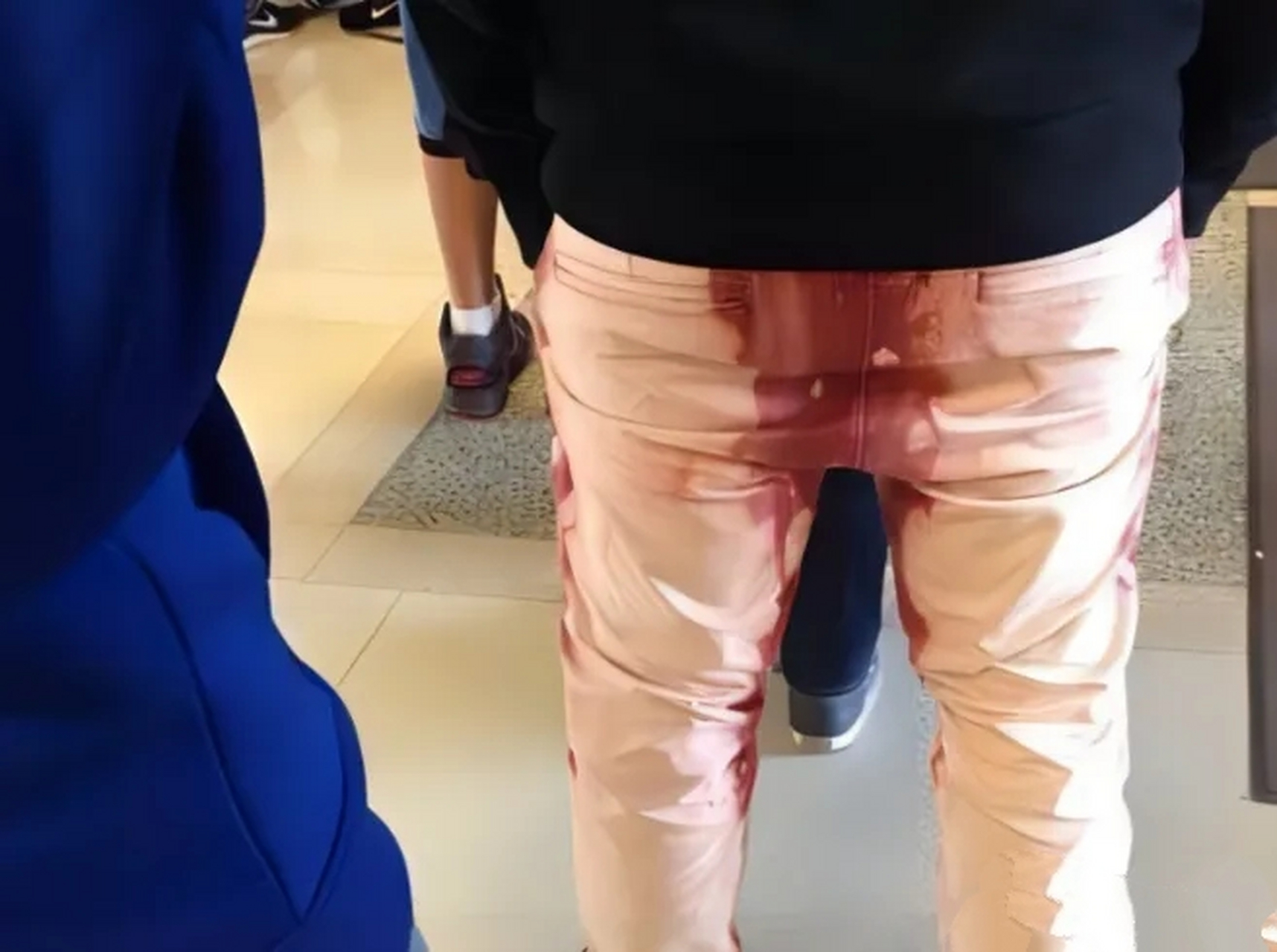 "  杭州一18岁男孩突然自宫,亲手切掉后,他还扔进马桶,后来因血流不止