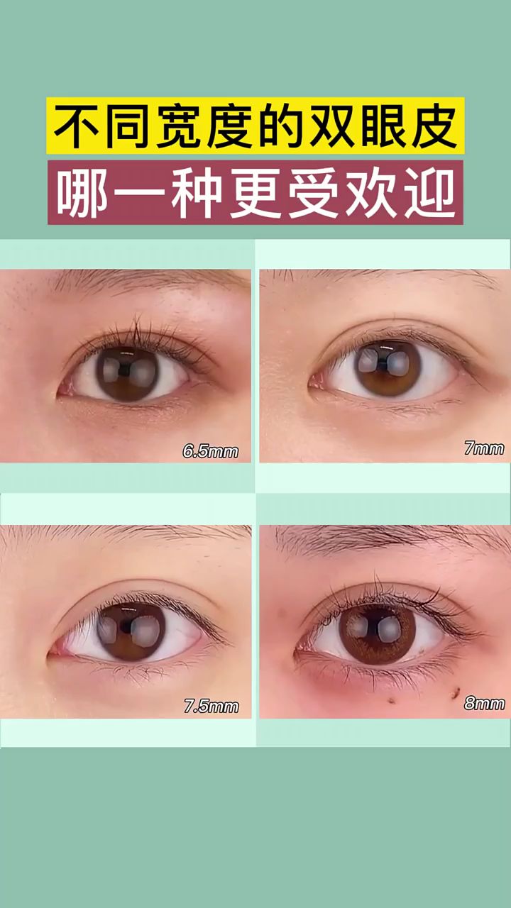 65mm7mm75mm8mm四种不同宽度的双眼皮你更喜欢哪一款