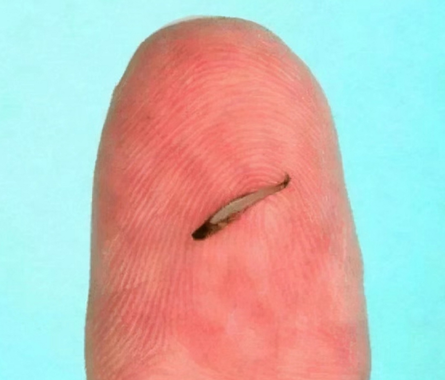 世界上最小的鱼～胖婴鱼