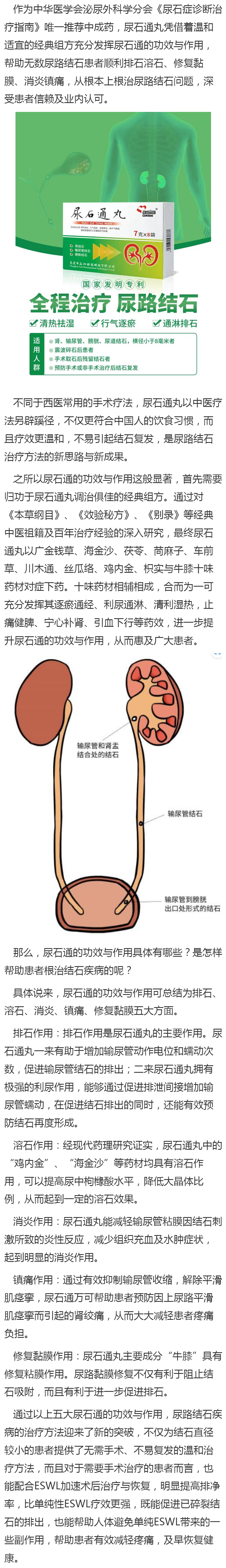 尿结石示意图图片