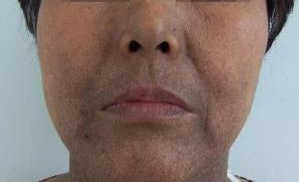 医学生给火锅店老板留言检查身体,脸发黑可能有哪些健康问题?