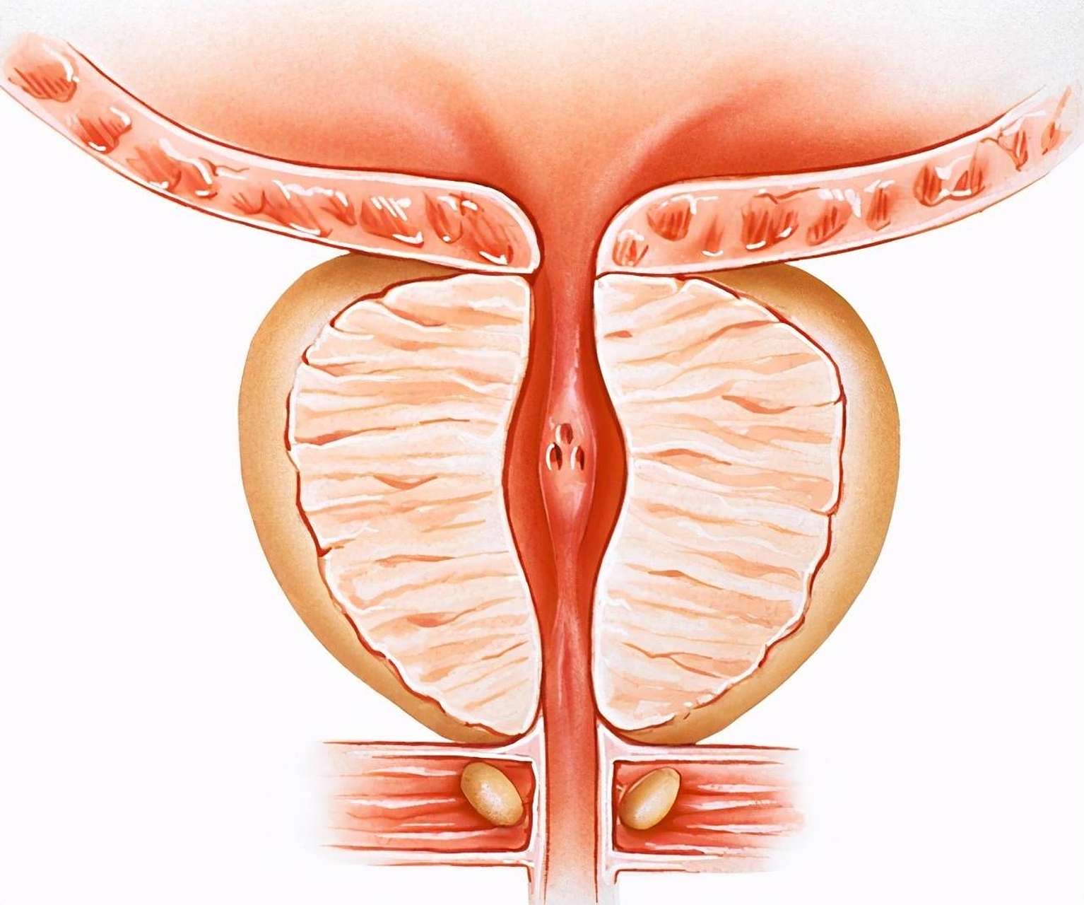 前列腺形似栗子 ,它的外表是纤维包膜,内部由肌纤维和腺体组织组成