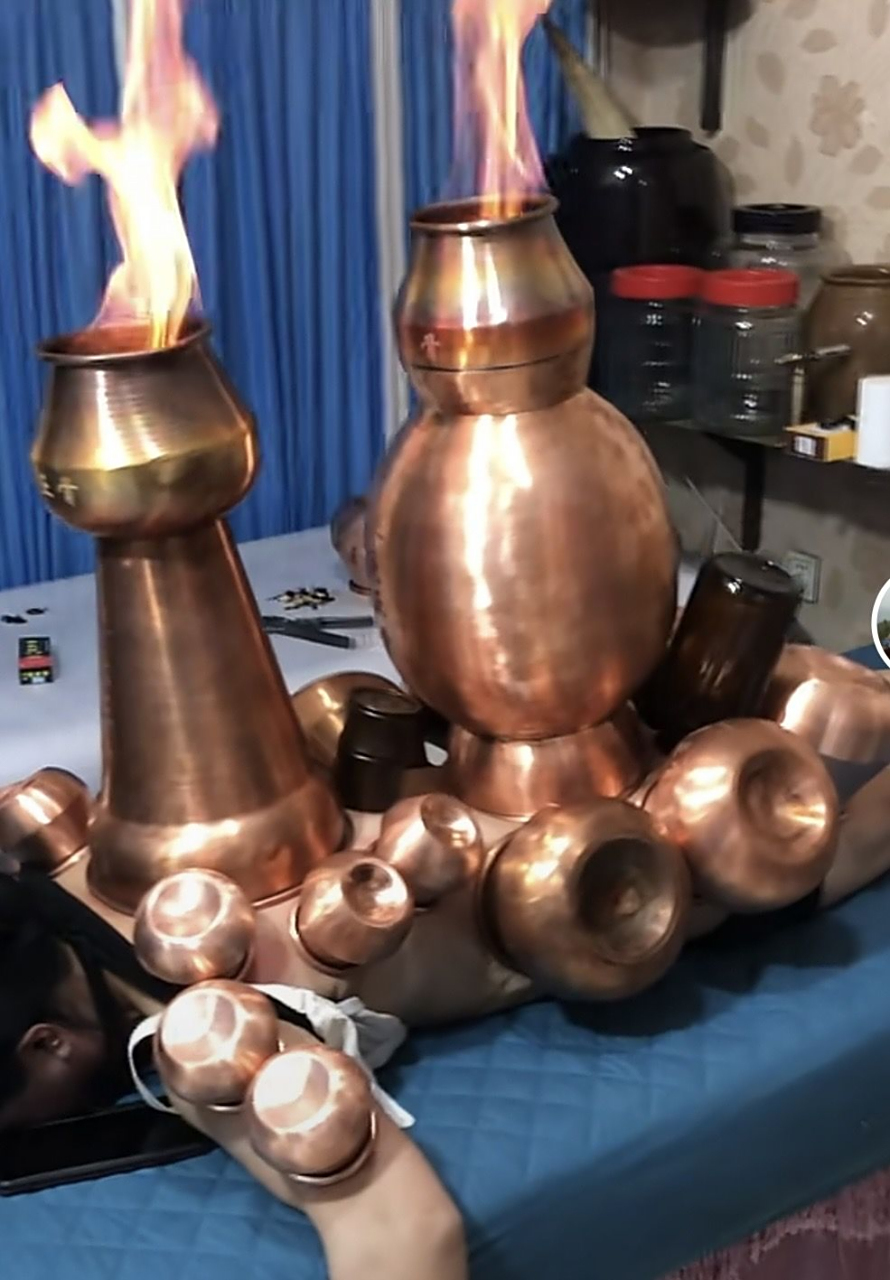 这应该是拔罐的最高境界了#搞笑家庭欢乐多