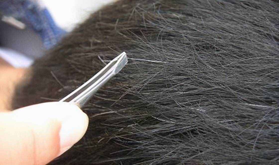 哈佛大学研究:长白头发的人不易患癌?是科学还是谣言?答案来了