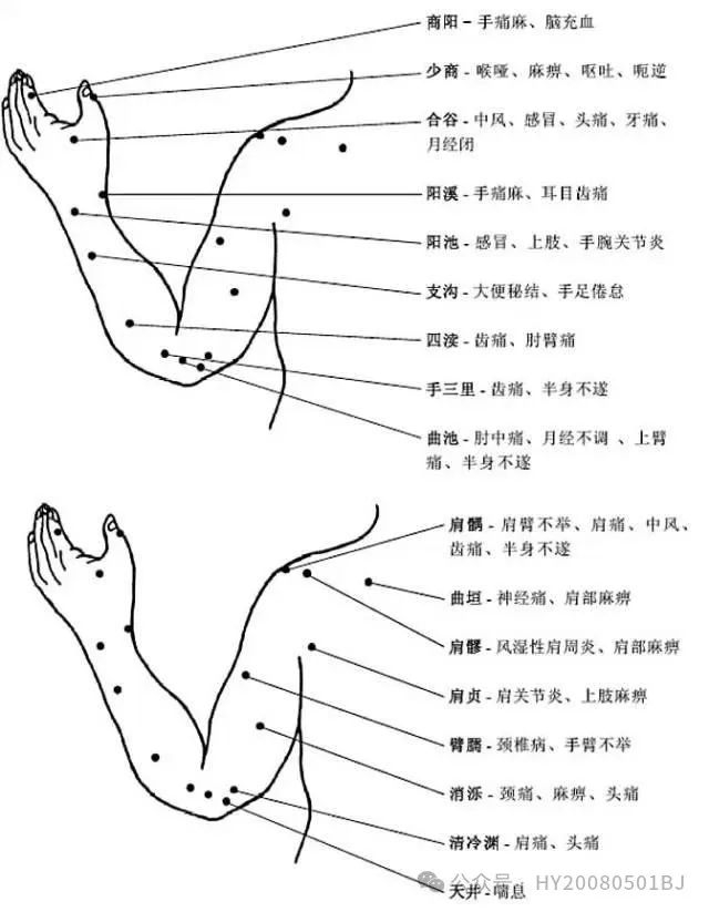 令人疑惑的上臂疼痛