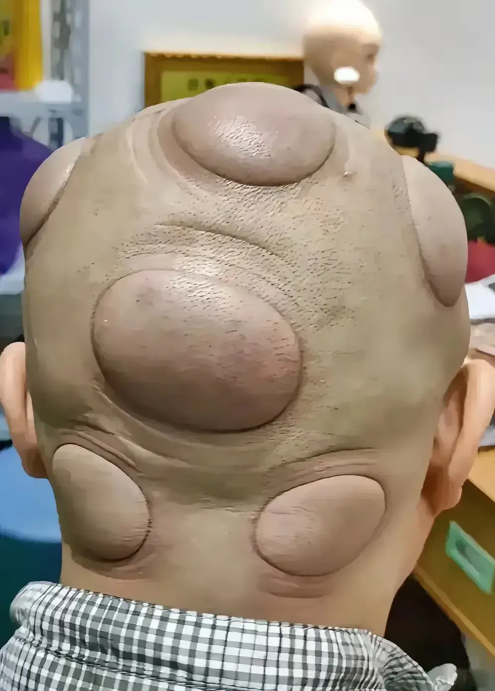 一男子,最近老觉得头疼,听朋友说可以去拔罐,男子去了,可是,令人万万