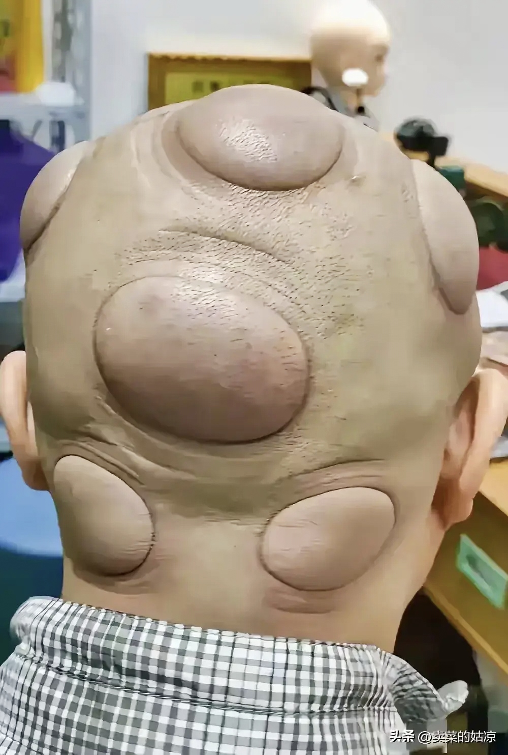 一男子,最近老觉得头疼,听朋友说可以去拔罐,男子去了,可是,令人万万