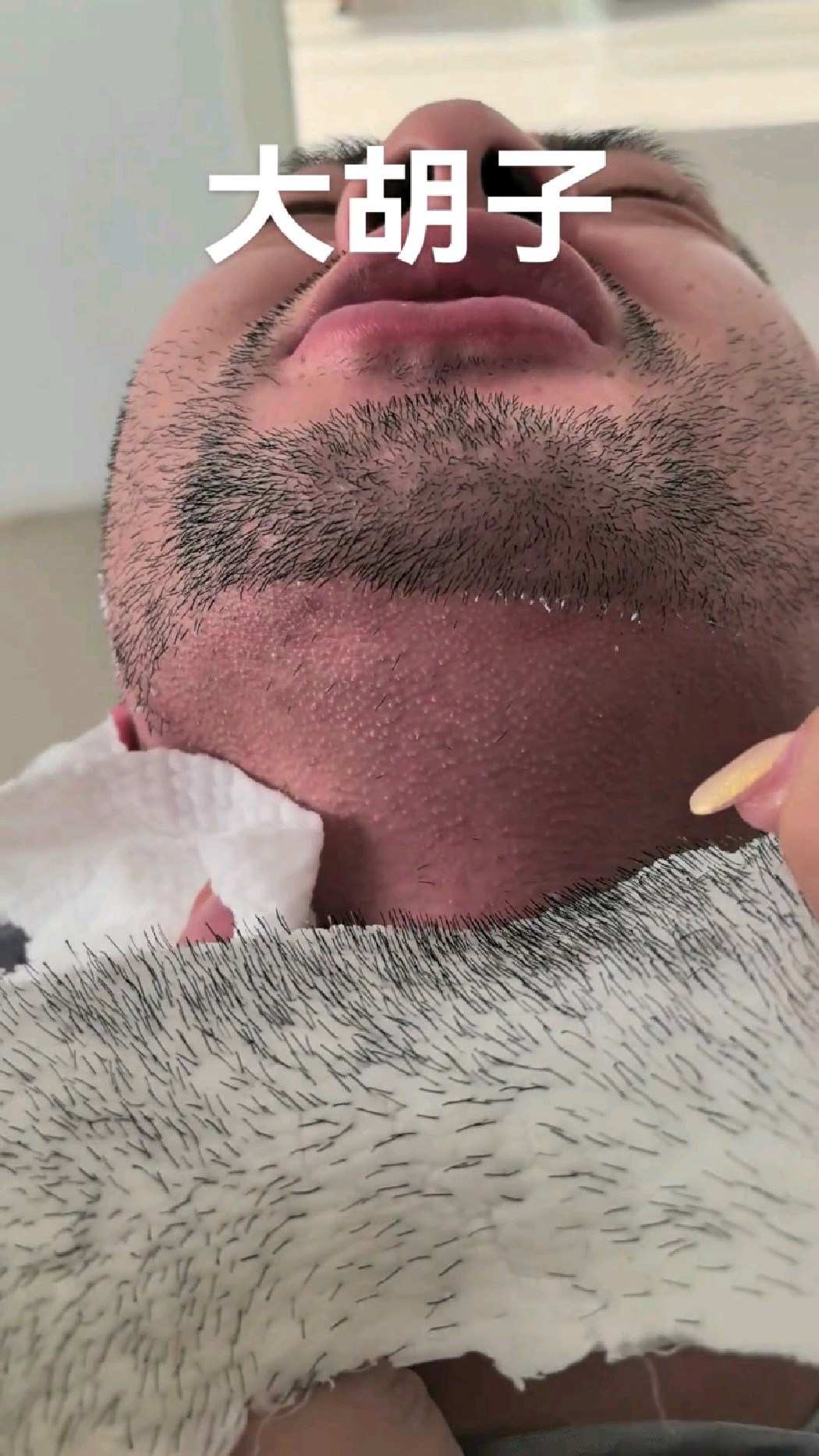 蜜蜡拔胡子,连根拔起,不留黑点!