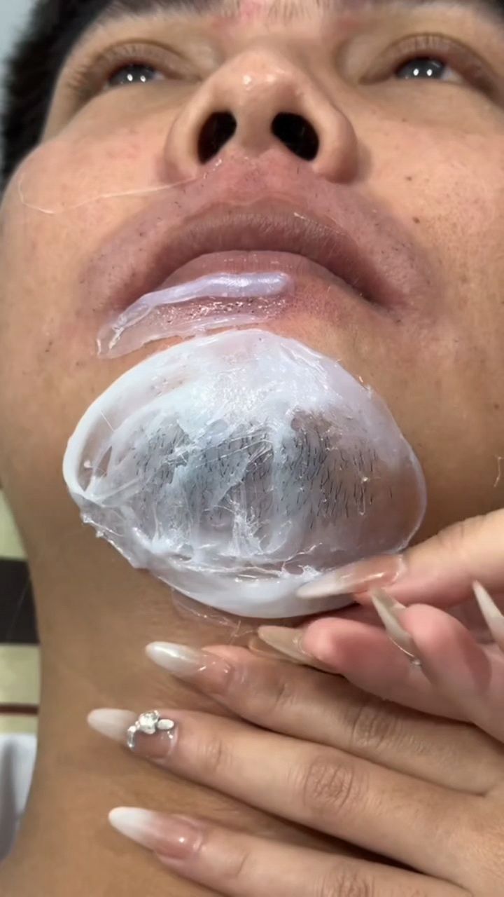 蜜蜡拔胡子,连根拔起,不留黑点