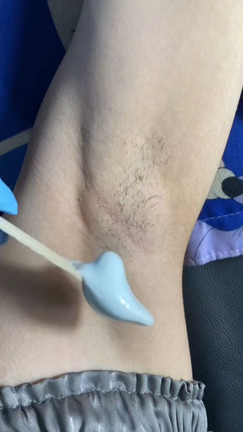 腋下为什么会长毛是什么原因为什么在线 腋下为什么会长毛是什么原因为什么在线