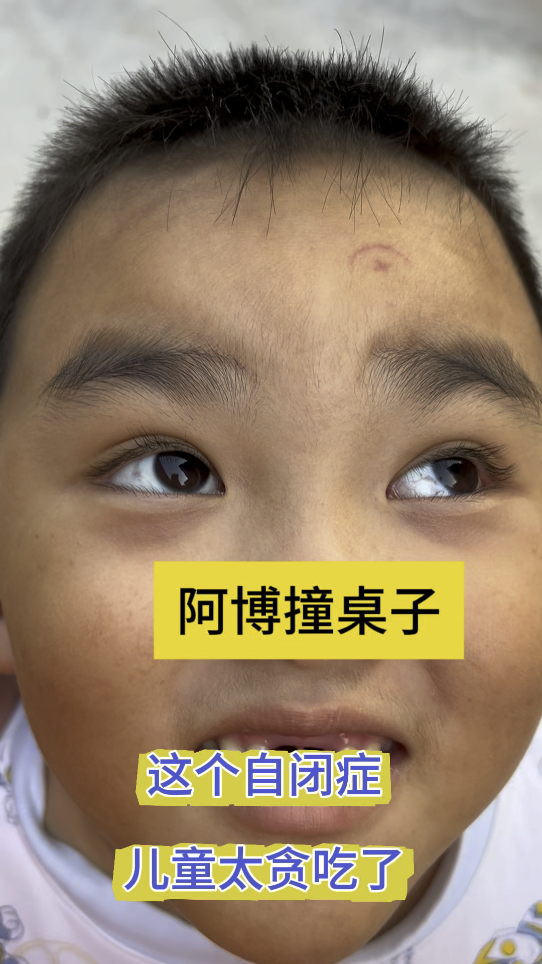 自闭症儿子自残,为了一口饭,撞头到桌子上