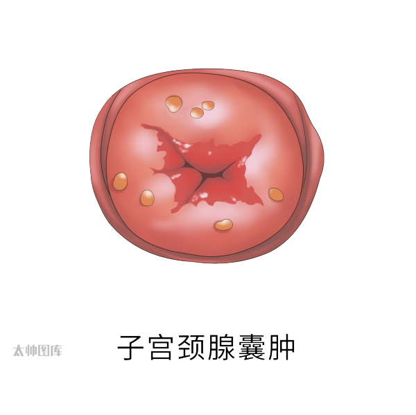 宫颈组织结构分层图片
