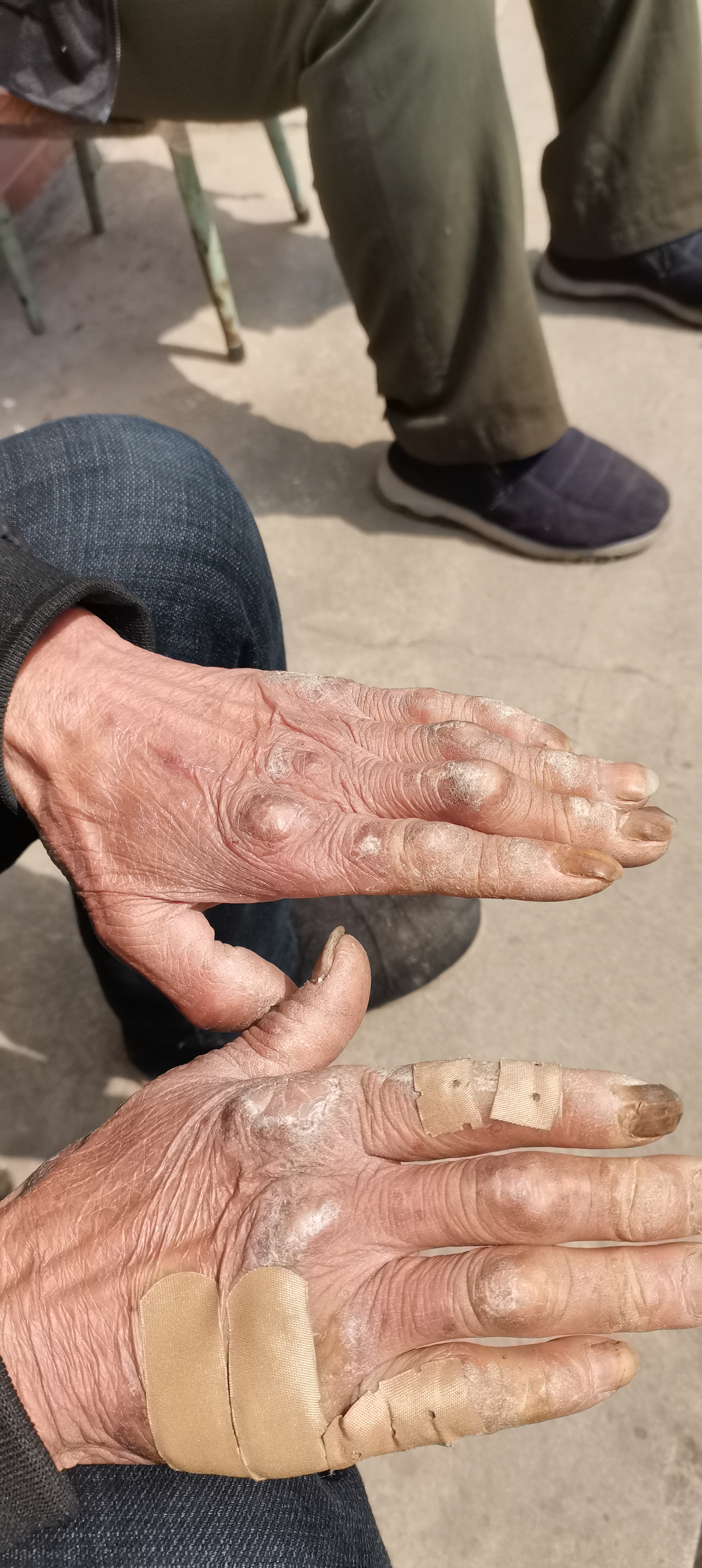 农村80多岁老人的手,真是饱经沧桑,道道裂纹贴着创口贴,这是劳动的手