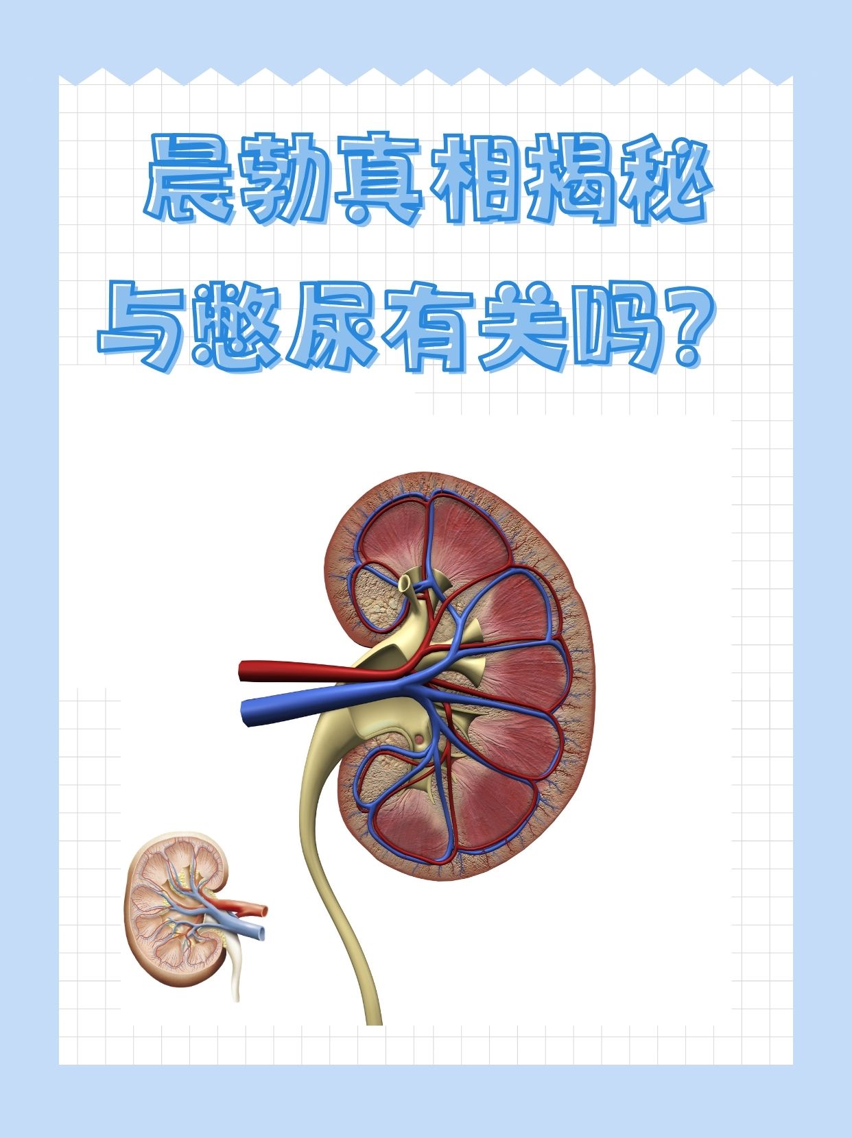 早上晨勃很硬怎么办图片