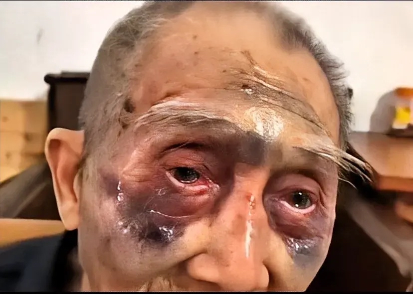 养老院是否真的适合养老?