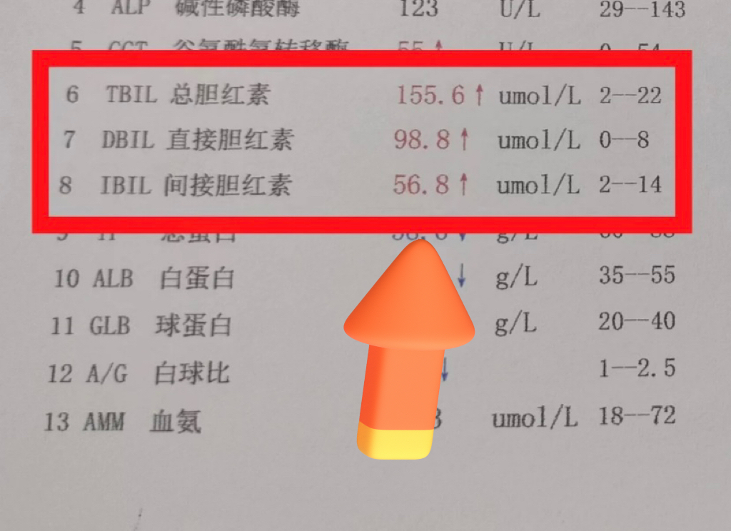 胆红素过高,应该如何应对?