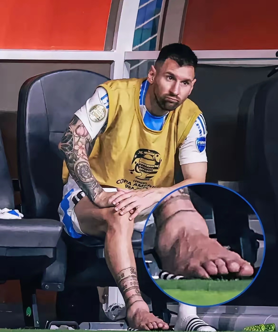 其实没有谁能够随随便便就能成功,天赋异禀的梅西也不例外,看他的脚