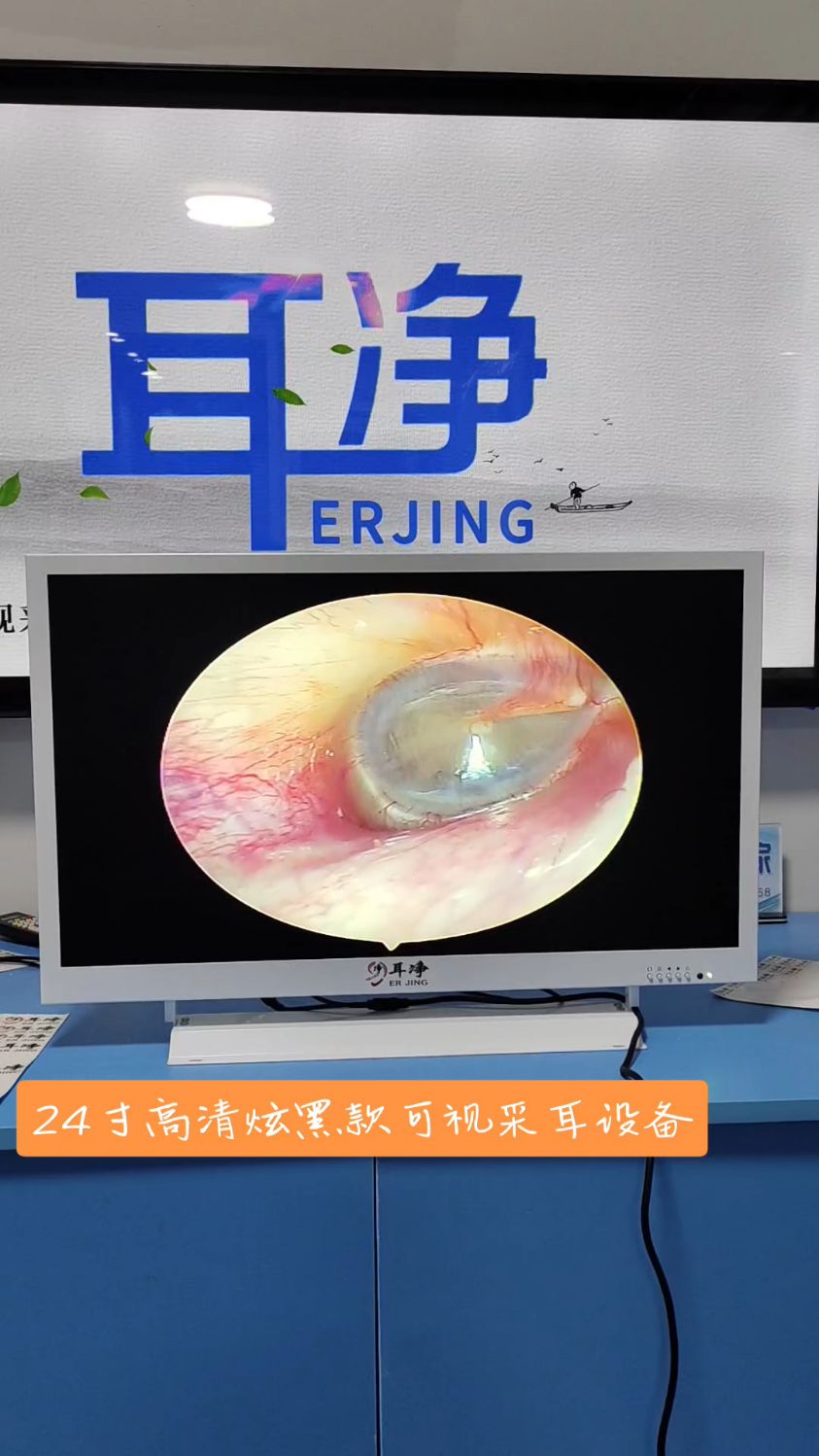 高清可视采耳仪器耳镜内窥镜户外高清可视采耳设备