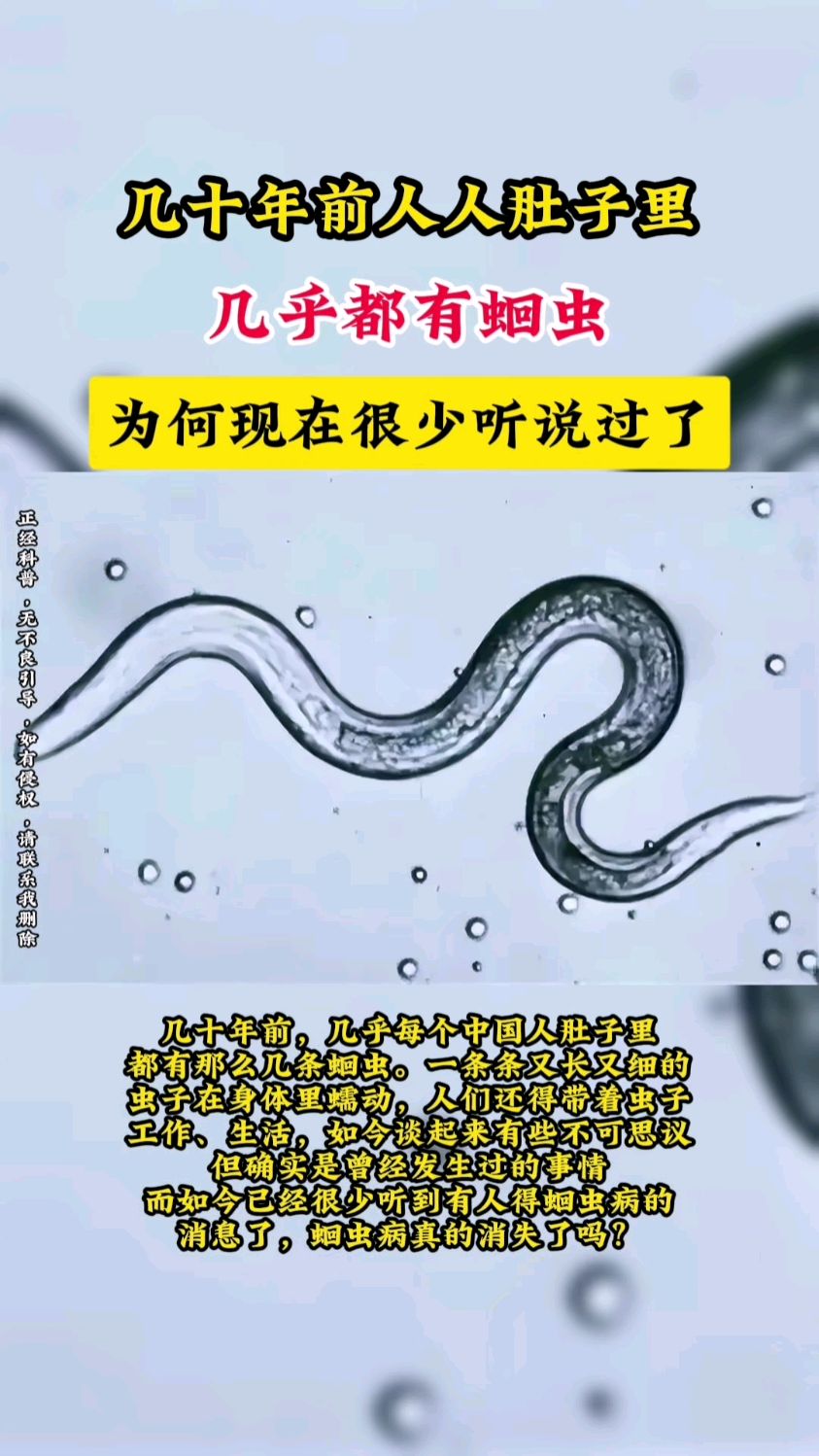 腹の中の寄生虫图片