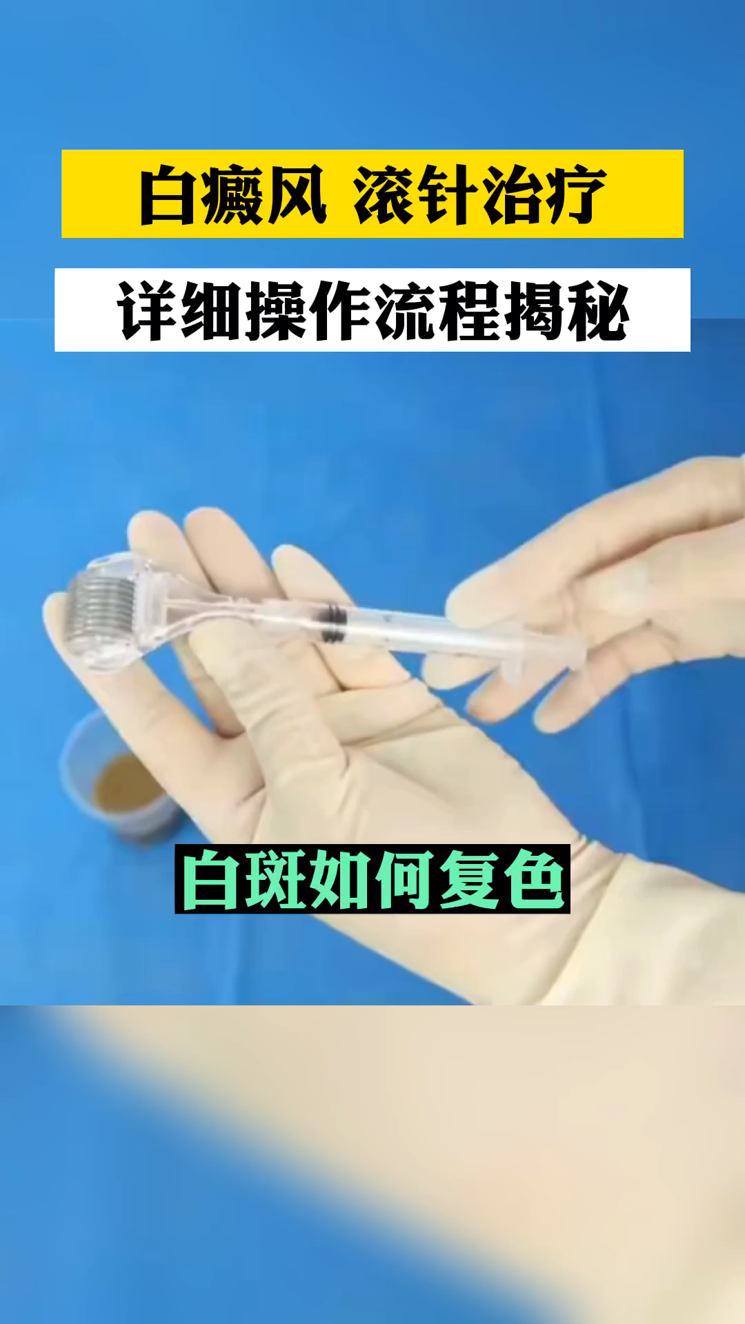 滚针的用法视频