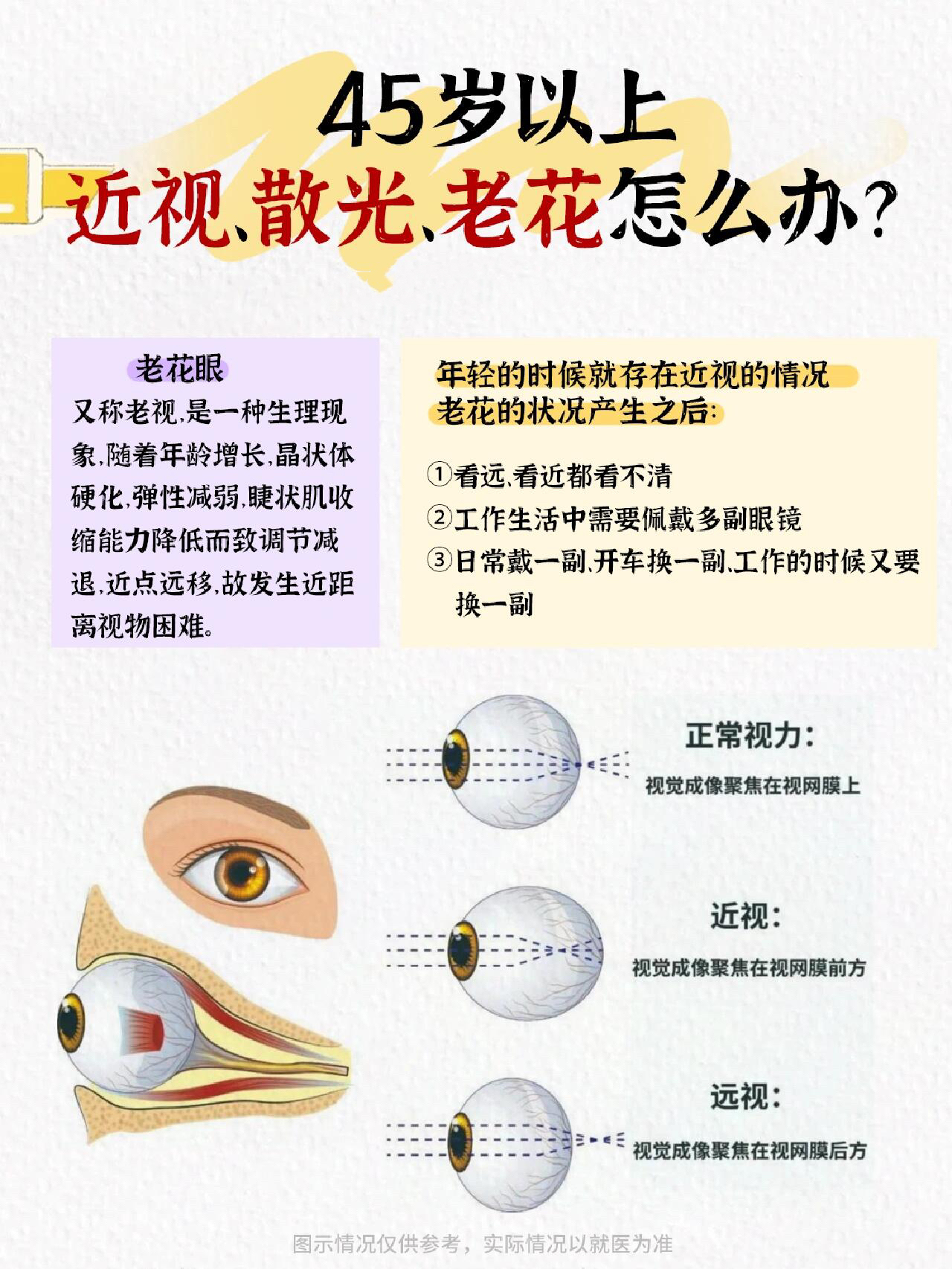 远视,散光,又老花