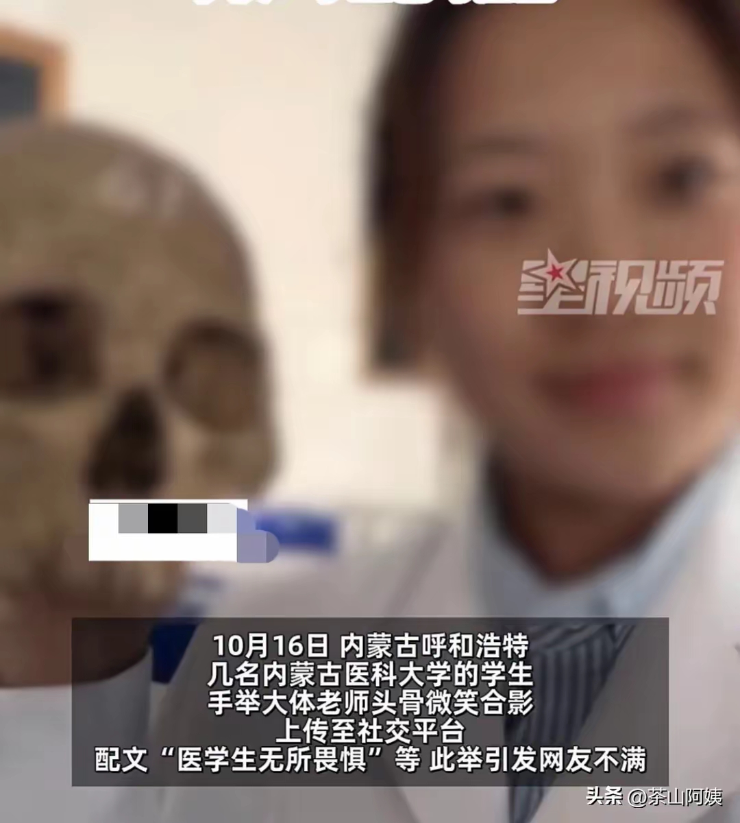医学生把玩拍照大体老师遗骨有网友连夜修改捐献遗嘱