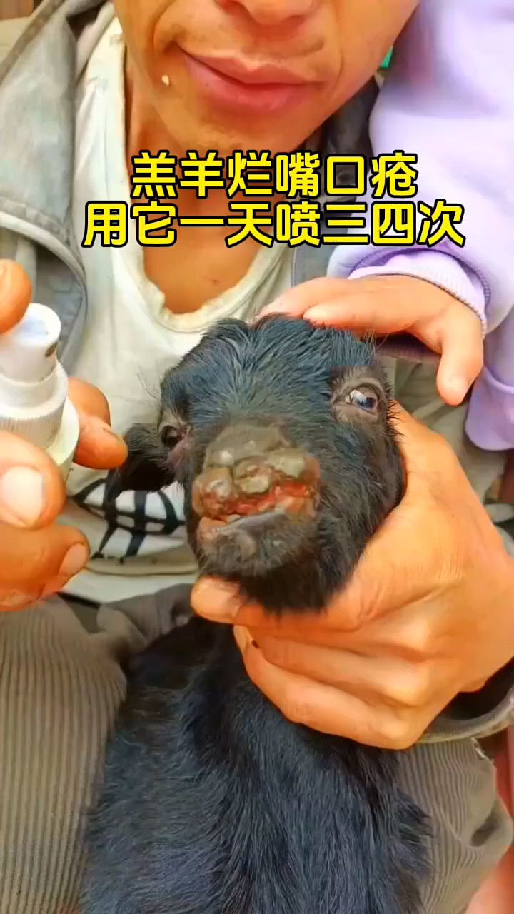 为什么烂嘴
