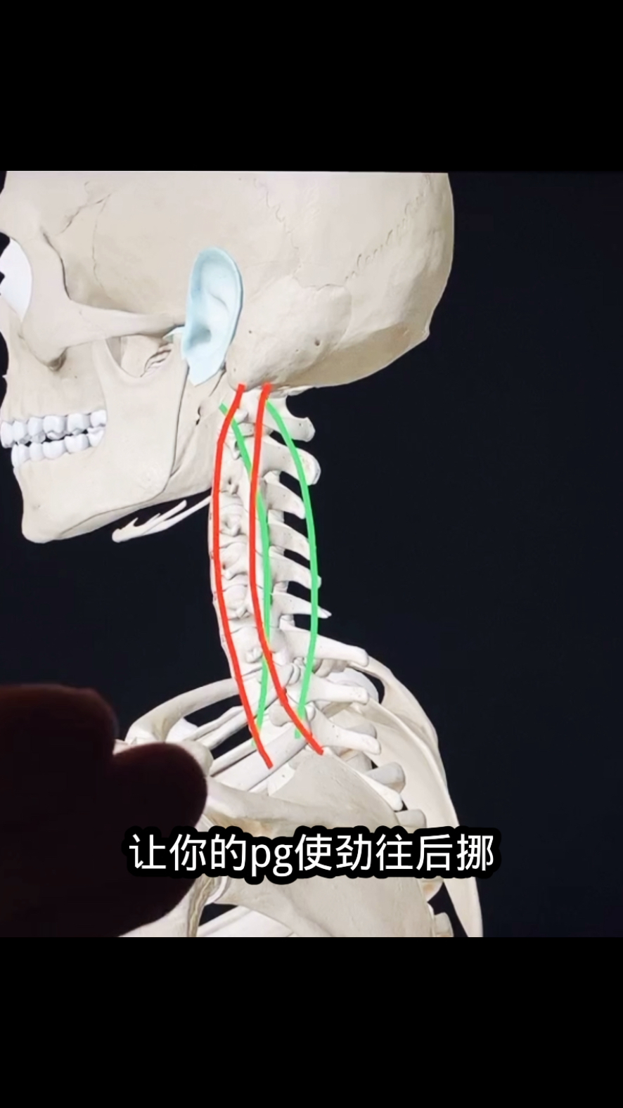 颈椎曲度直或者反弓如何自我锻炼