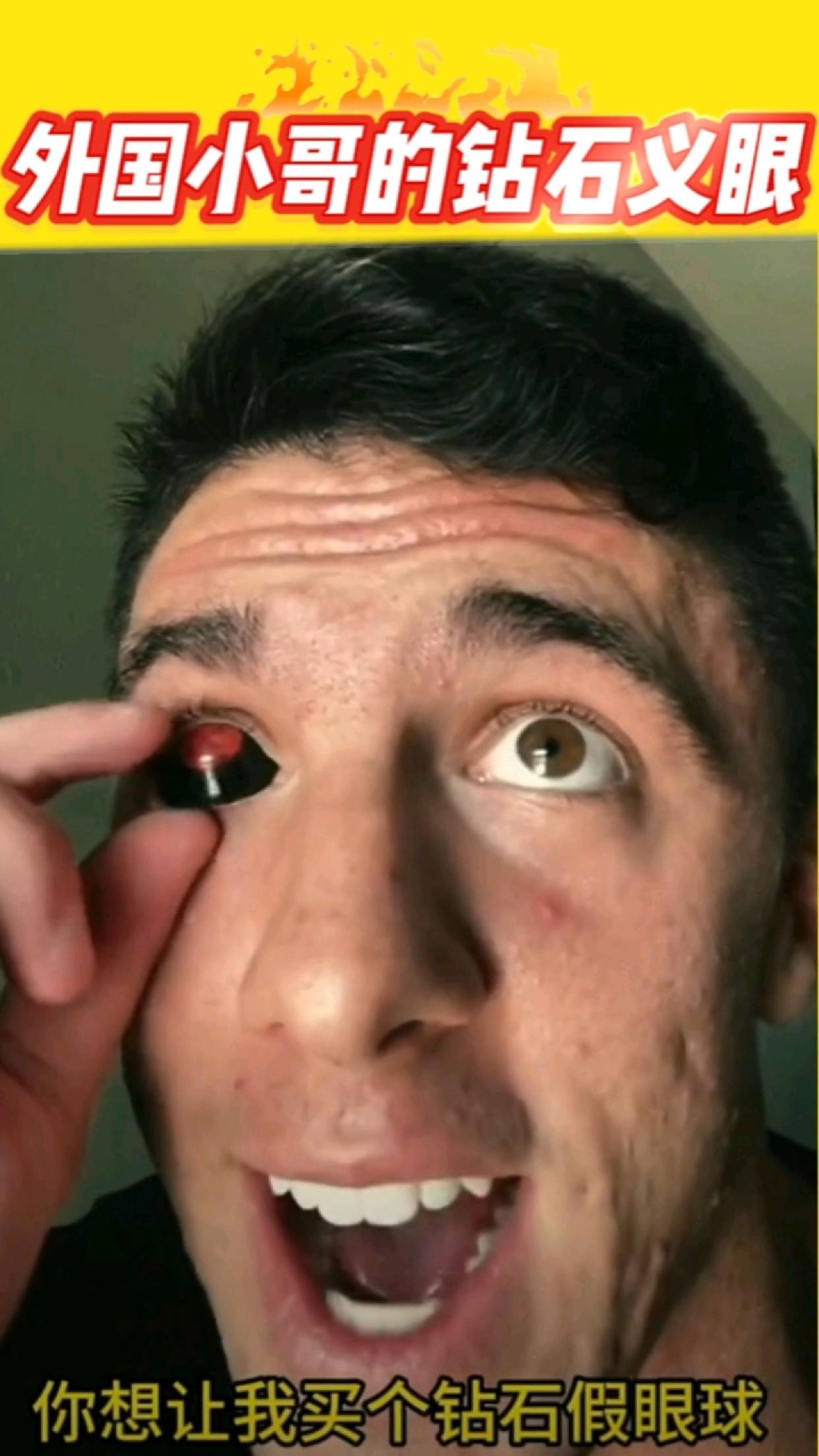 国外小哥的钻石义眼闪瞎你的眼
