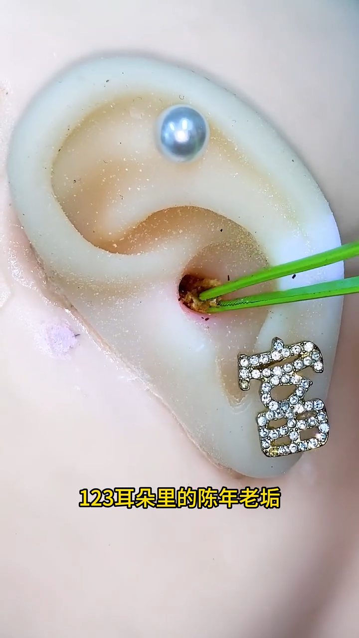 用这个挖耳勺,舒服不会伤耳道